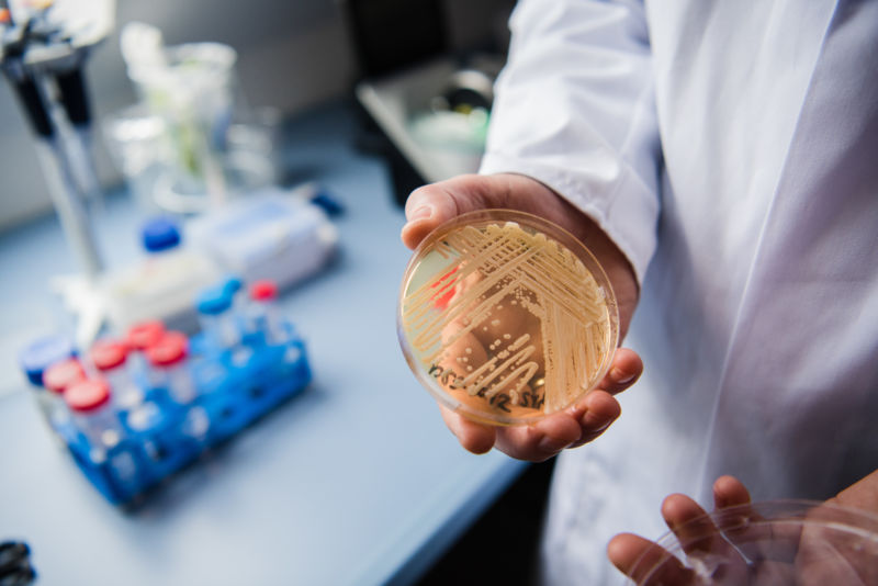 The director of the German National Reference Centre for Invasive Fungus Infections holding a petri dish of the yeast <em>Candida auris</em> in January 2018. 