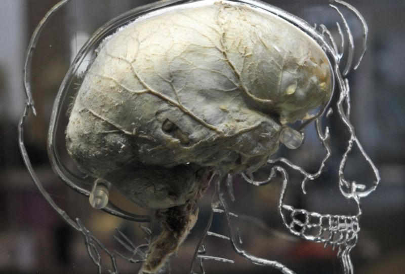 A real human brain suspended in liquid within a human silhouette carved into acrylic, on display at the Bristol Science Centre in England. New research finds more evidence that the brain operates near a critical point.